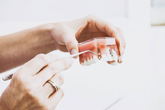 Cosmetic dentures - Advanced Prosthetics Ltd